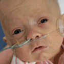 Action Medical Research